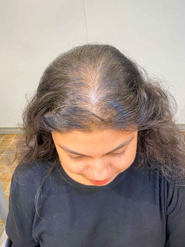 Volume booster( Hair topper)